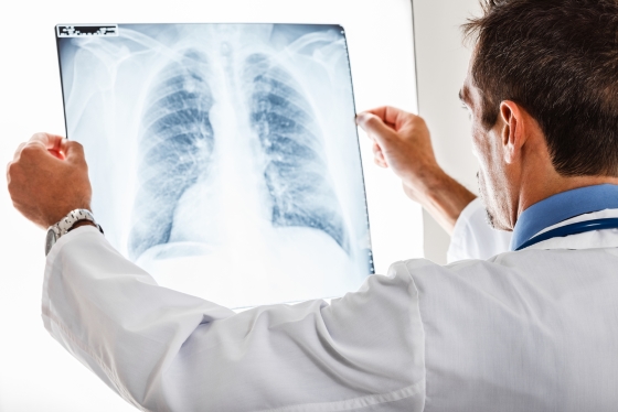 defect-septal-ventricular-diagnostic