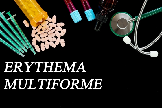 eritem-polimorf-cauze-simptome-si-tratament