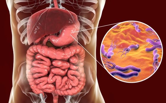 eructatii-helicobacter-pylori