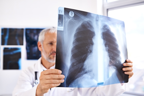 fibroza-interstitiala-cauze-simptome-tratament
