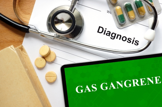 gangrena-gazoasa-cauze-simptome-tratament