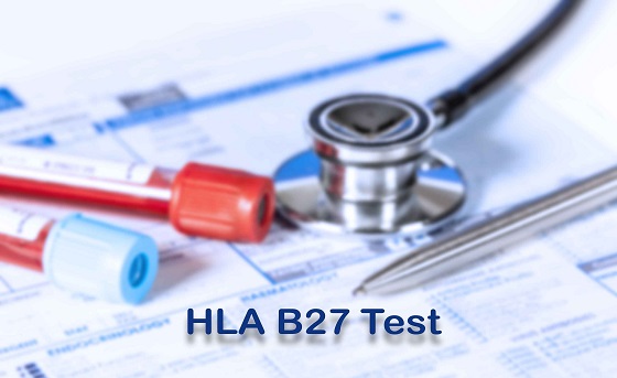 HLA-B27 
