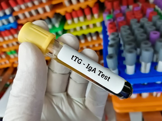 IgA-test