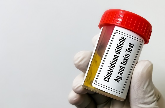 Infectia-cu-Clostridium-difficile