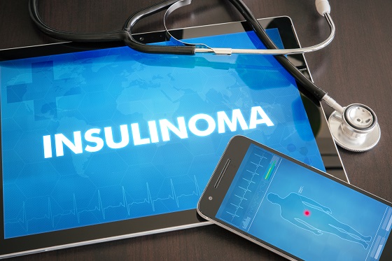 Insulinom-ul