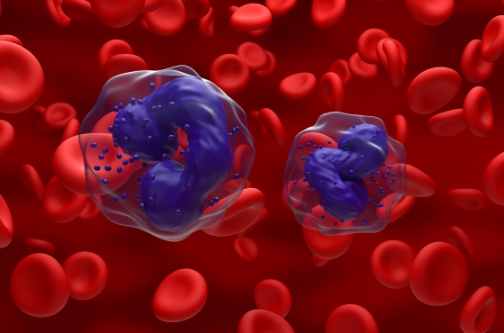 leucemie-mieloida-cronica-cauze-simptome-tratament-si-prognostic