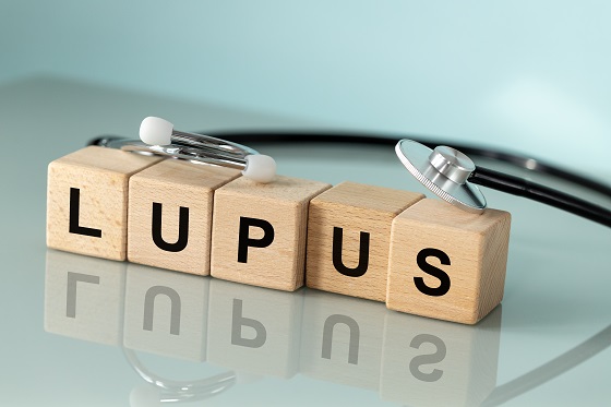 Lupus