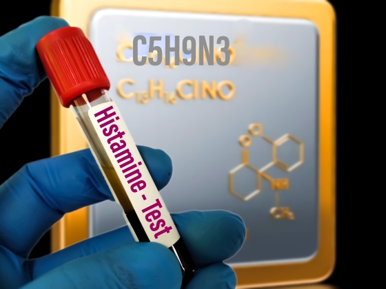 mastocitoza-si-excesul-de-histamina
