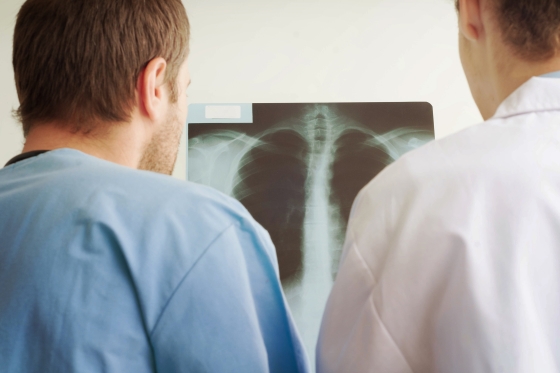 Micronoduli-pulmonari-cauze-diagnostic-si-tratament