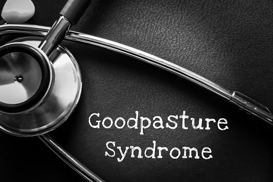 Sindrom-Goodpasture