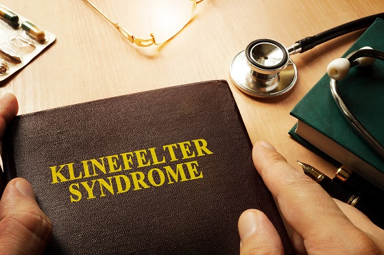 Sindrom-Klinefelter