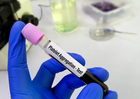 Test-agregare-plachetara
