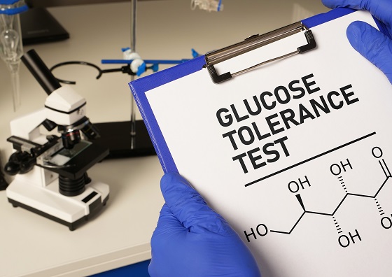 Test-toleranta-glucoza