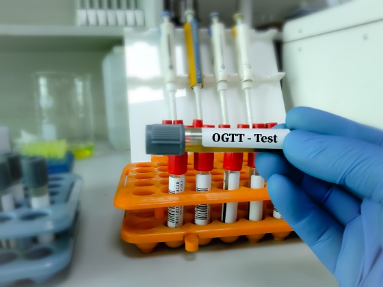 Test-toleranta-la-glucoza