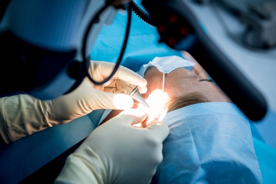 timpanoplastie