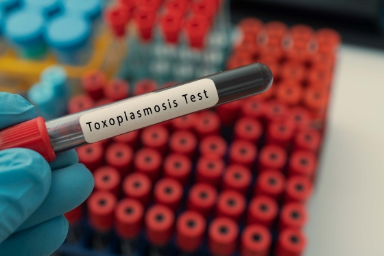 toxoplasmoza-diagnostic