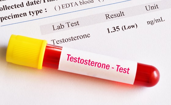 Tratament-cu-testosteron-la-barbati