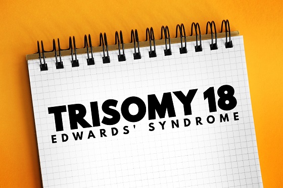 Trisomia-18