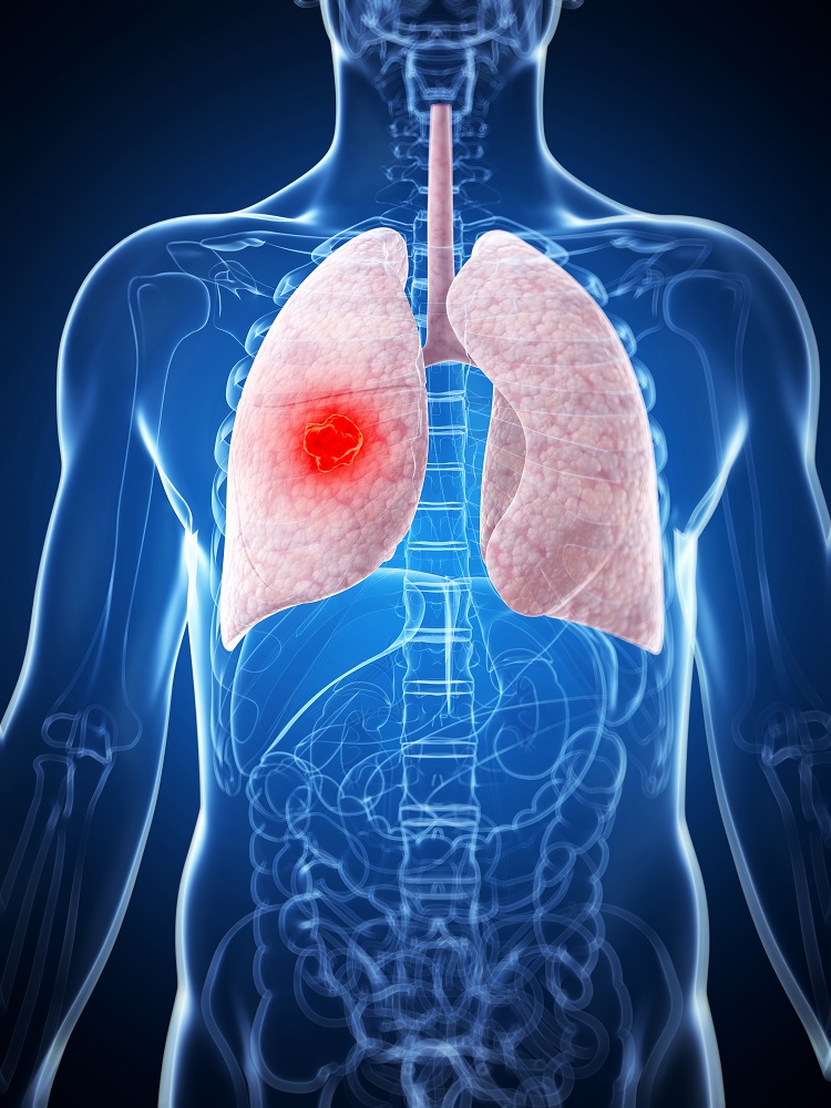 Regenerarea tesutului pulmonar