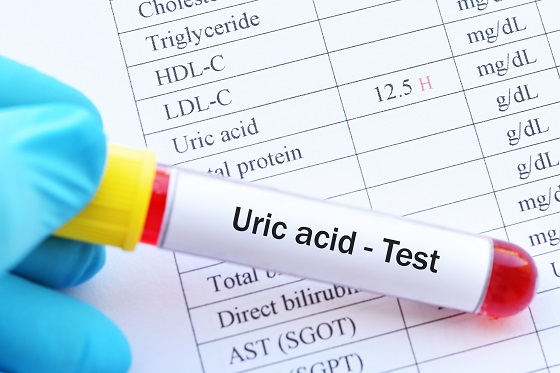 acid-uric