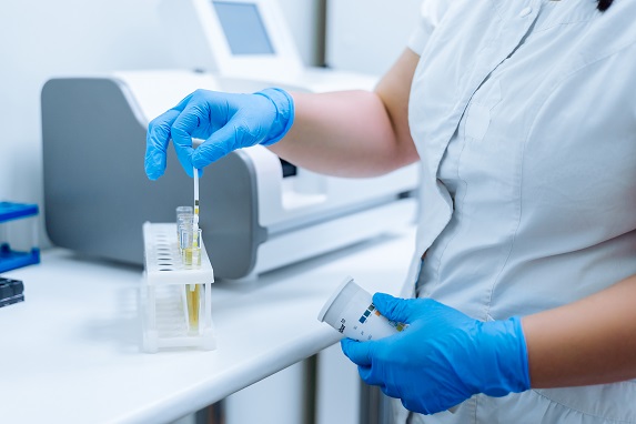 prelucrare-urina-laborator