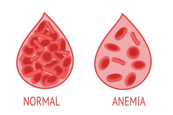 anemie-lipsa-pofta-de-mancare