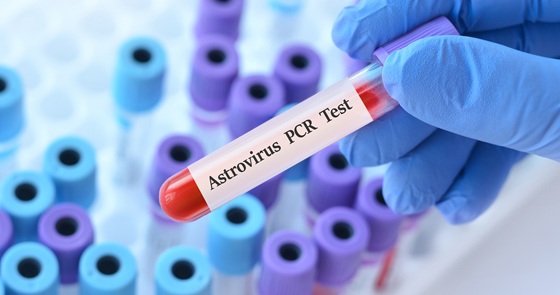 astrovirus