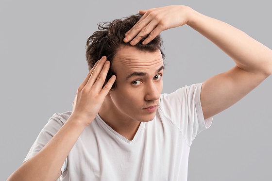 caderea-parului-la-barbati
