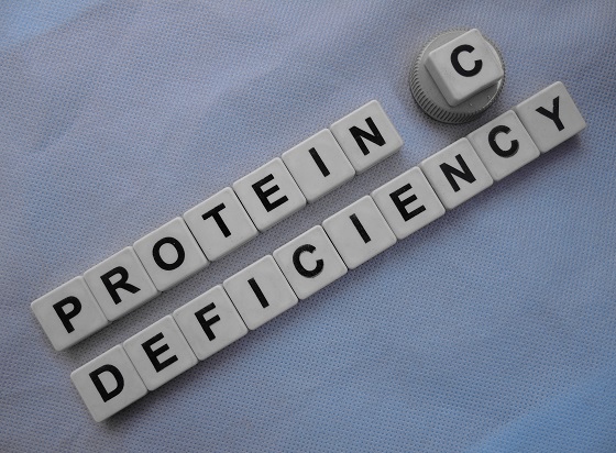 deficit-de-proteine