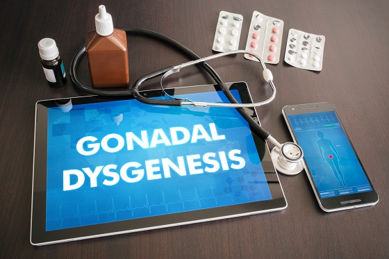disgenezie-gonadală