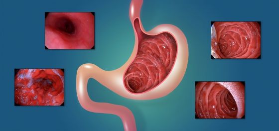 gastrita-antrala-eritematoasa-simptome