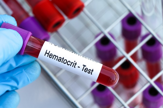 test de sange - hematocrit