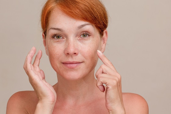 petele-solare-de-pe-ten