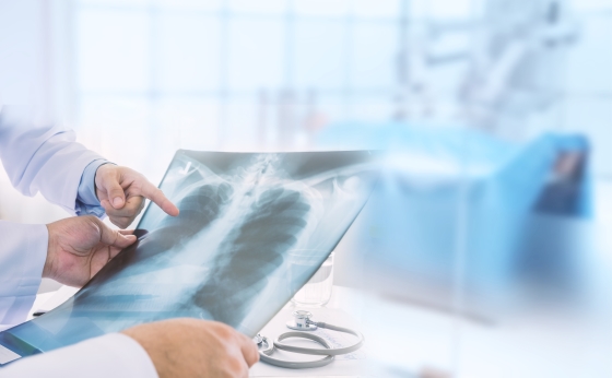 radiografie-pulmonara