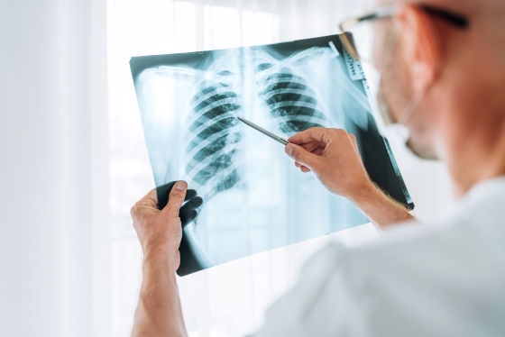 radiografie-pulmonara 