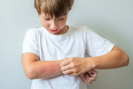 probleme dermatologice copii