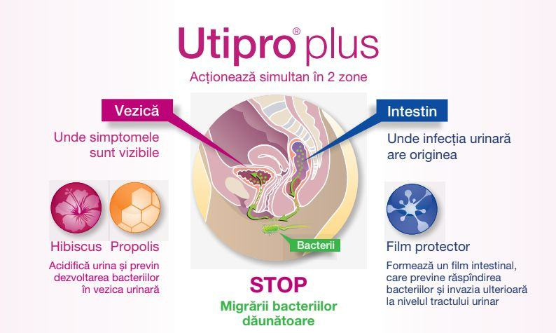 Urifast - trateaza usor si rapid o infectie urinara - Magazin online cu suplimente alimentare