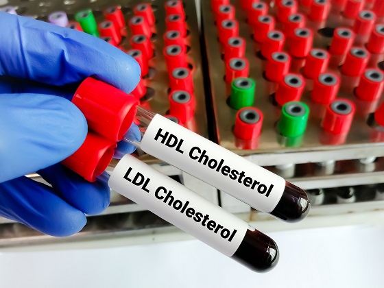 teste pentru colesterolul LDL si HDL