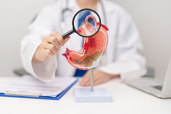 ulcer-gastric